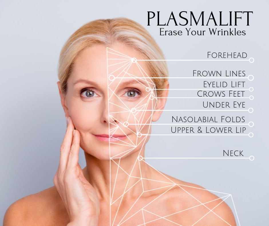 PLASMALIFT - ERASE YOUR WRINKLES INSTANTLY!